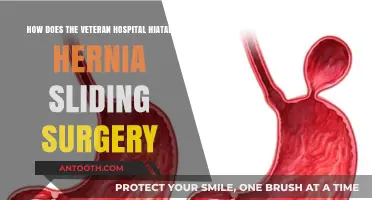 Veteran Hospital Hiatal Hernia Sliding Surgery: Procedure and Recovery Explained