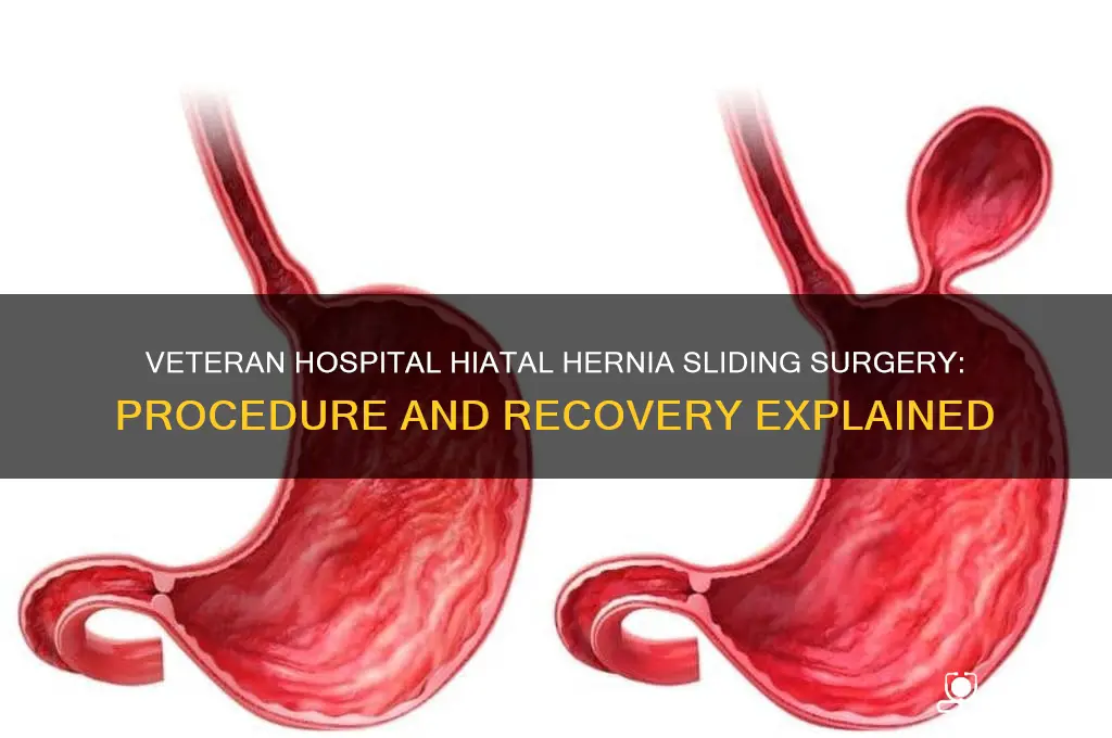 how does the veteran hospital hiatal hernia sliding surgery