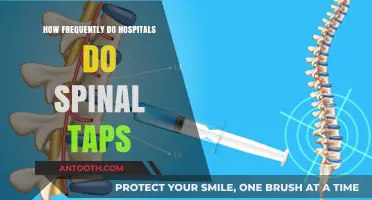 Spinal Tap Frequency: How Often Do Hospitals Perform Them?