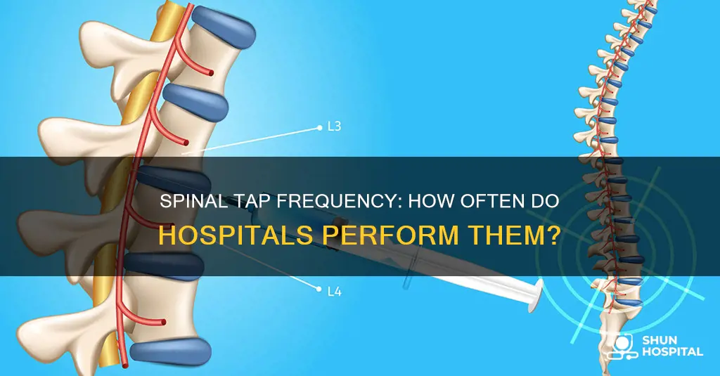 how frequently do hospitals do spinal taps