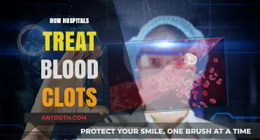 Effective Blood Clot Treatment Strategies in Modern Hospitals Explained