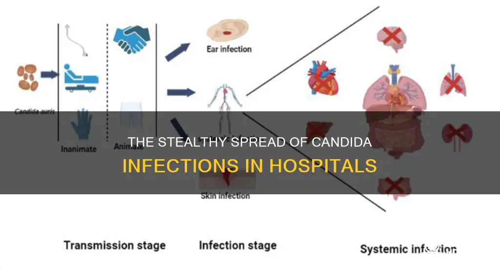 how invasive candida infection spreads in hospitals