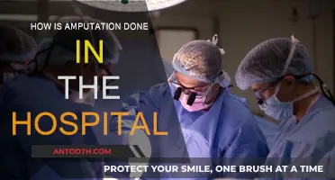 Amputation Procedures: What to Expect in the Hospital