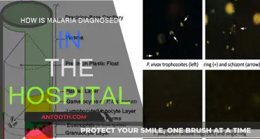 Malaria Diagnosis: Hospital Procedures and Protocols