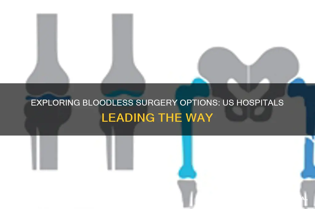 how many bloodless surgery hospitals are there in the us
