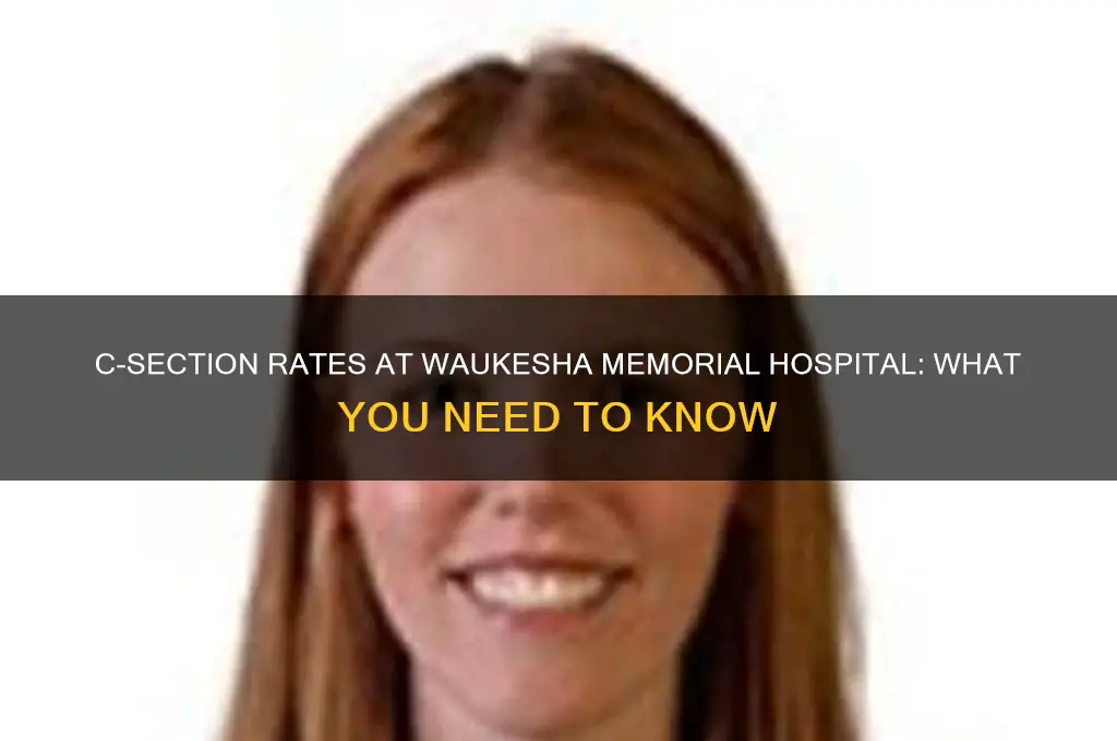 how many c sections are done at waukesha memorial hospital