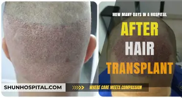 Post-Hair Transplant Hospital Stay: What to Expect After Surgery