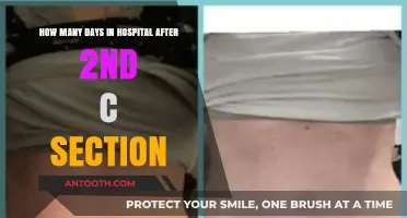 Recovery Timeline: Hospital Stay After Your Second C-Section Explained