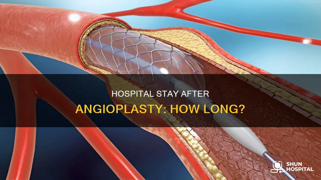 how many days in hospital after angioplasty