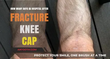 Knee Cap Fracture Recovery: Hospital Stay Duration Explained