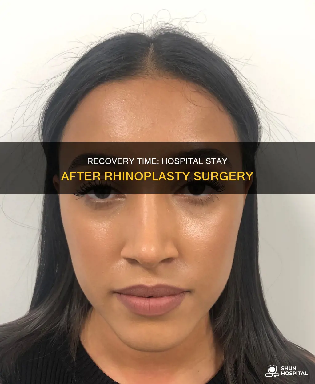 how many days in hospital after rhinoplasty