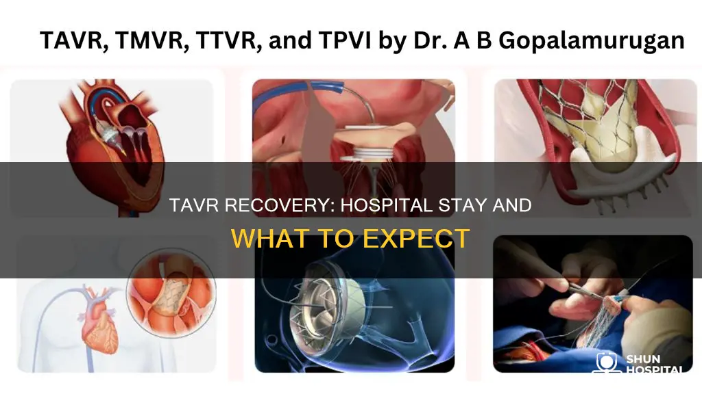 how many days in hospital after tavr