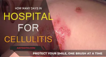Hospital Stay for Cellulitis: How Long?