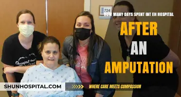 Understanding Hospital Stay Duration After Amputation: What to Expect