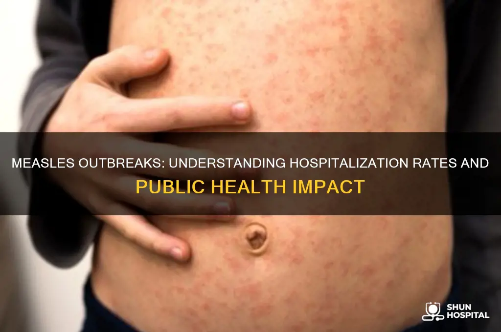 how many hospitalizations from measles
