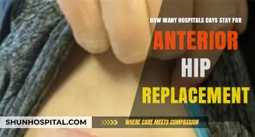 Average Hospital Stay Duration for Anterior Hip Replacement Surgery Explained