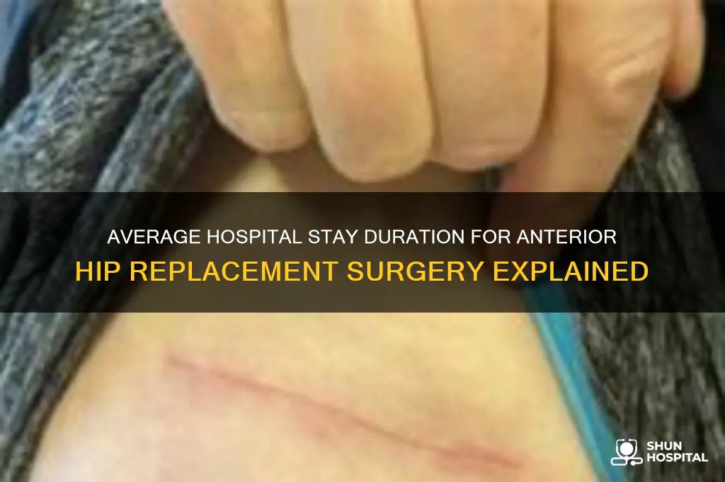 how many hospitals days stay for anterior hip replacement