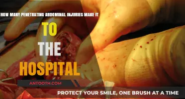Penetrating Abdominal Injuries: Hospital Arrival Rates and Survival Insights