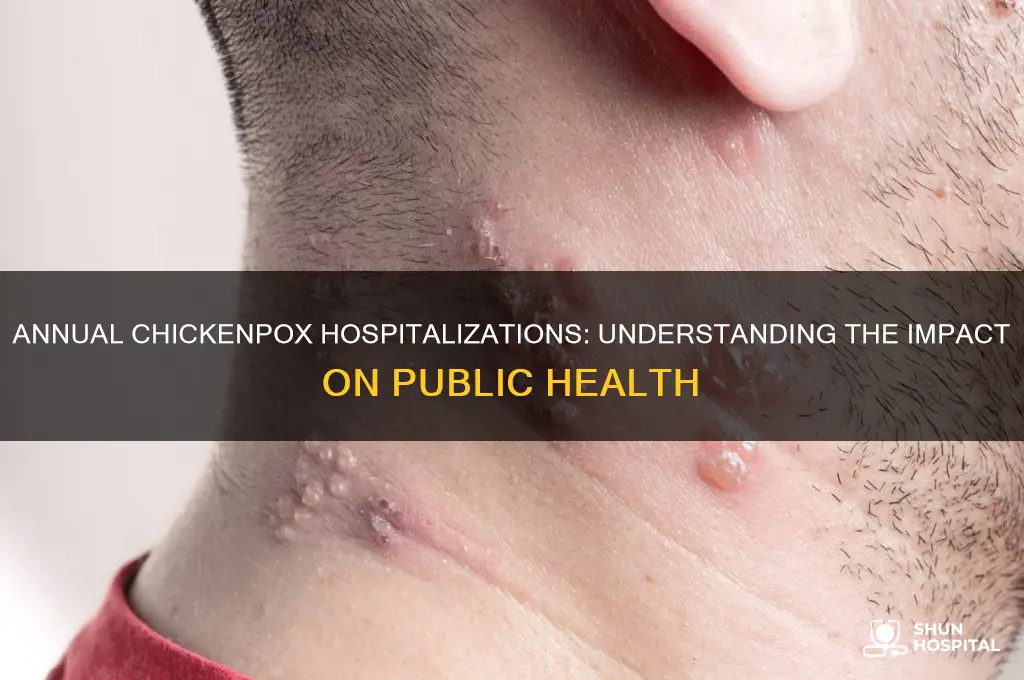 how many people are hospitalized from chickenpoxs a year