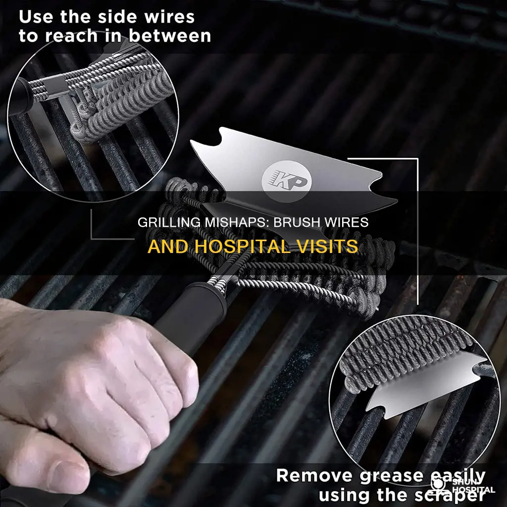 how many people grill brush wires hospital