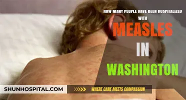 Measles Outbreak in Washington: Hospitalization Numbers and Public Health Response