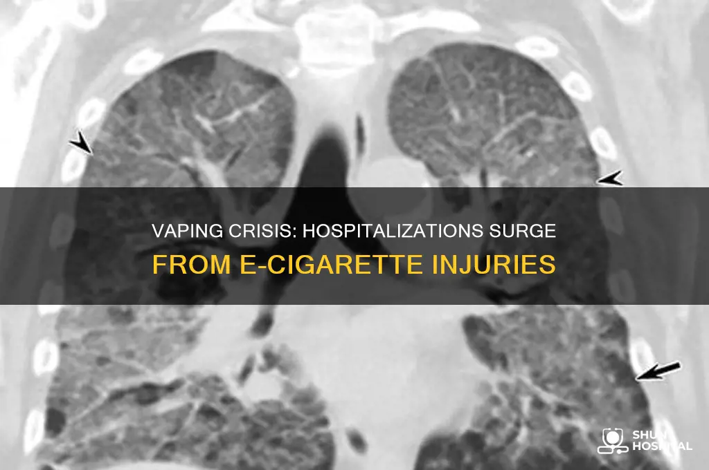 how many people have been hospitalized with vape injuries