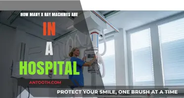 X-Ray Machines in Hospitals: Understanding Their Quantity and Role