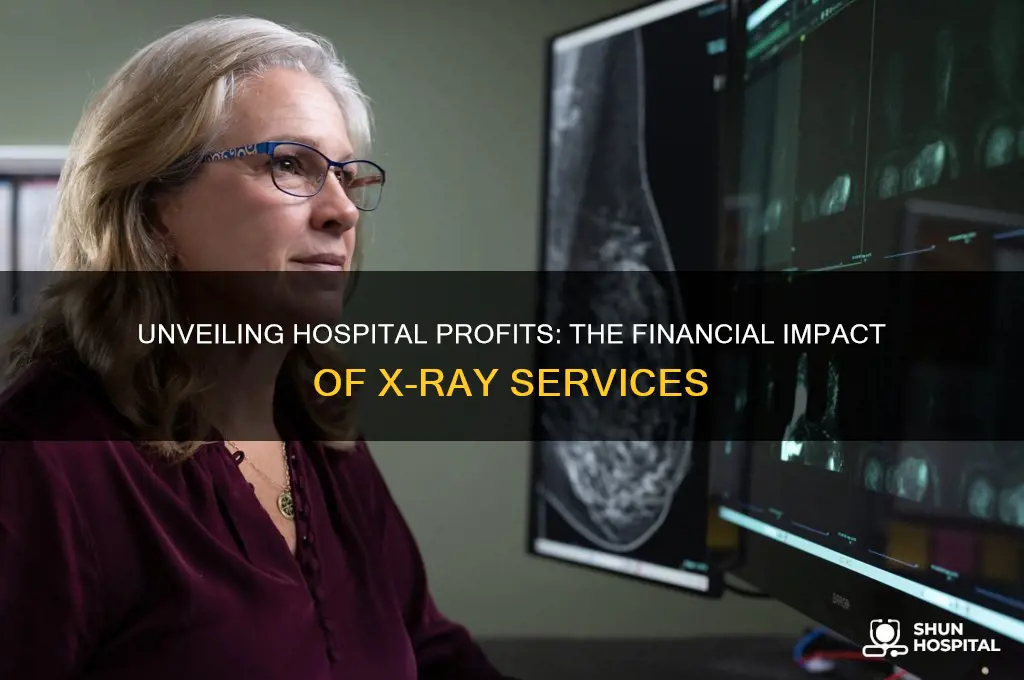 how mich doez the hospital make from x rays