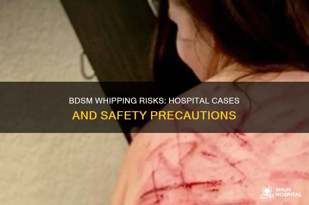 how often do whipping bdsm wind up as hospital cases