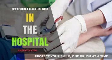 Understanding Hospital Blood Test Frequency: What Patients Need to Know