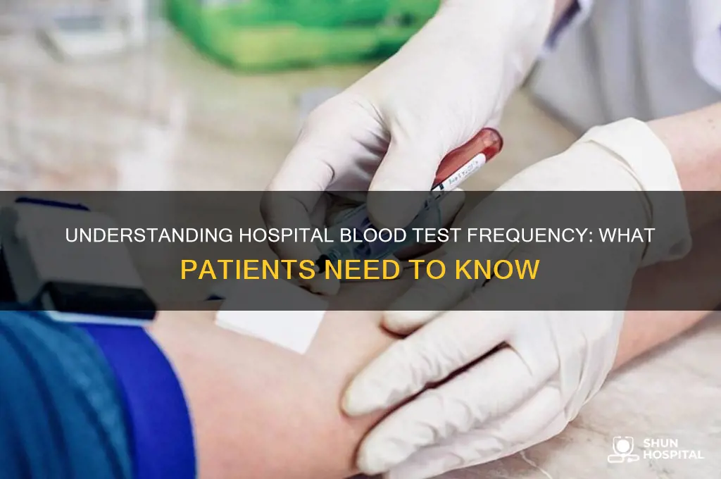 how often is a blood test when in the hospital