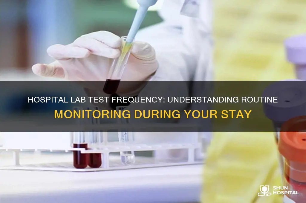 how often is lab tests done while in the hospital