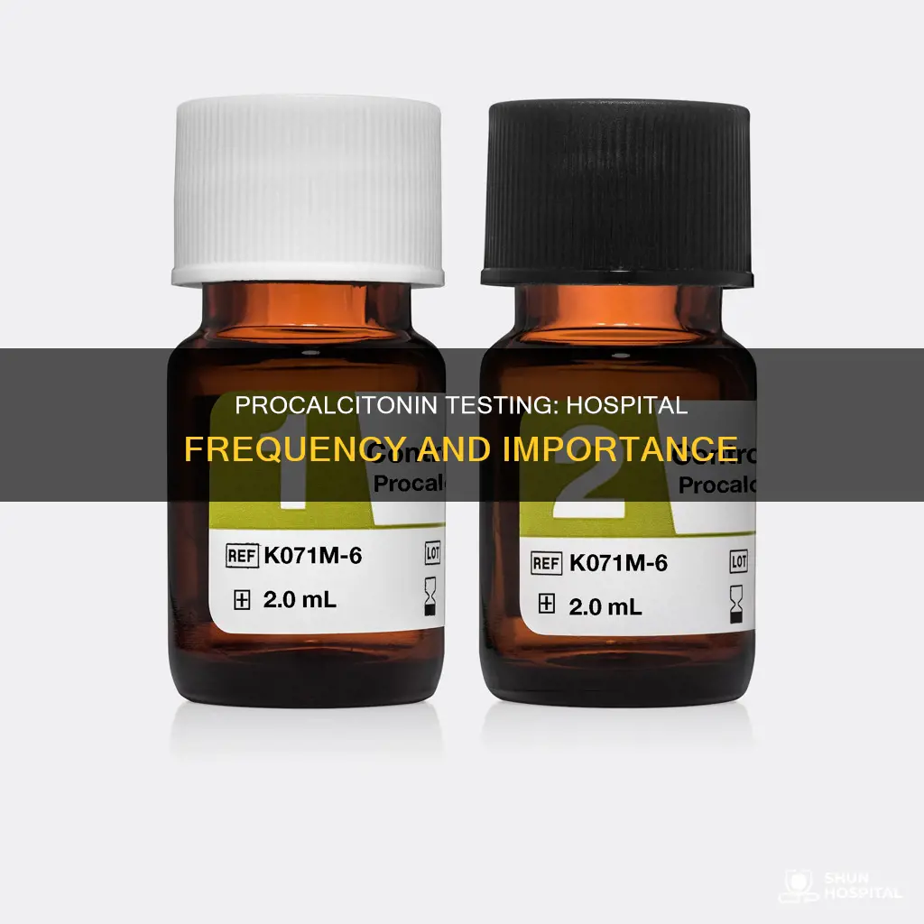 how often is procalcitnonin measured in hospital