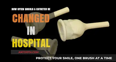 Optimal Catheter Change Frequency in Hospitals: Guidelines and Best Practices