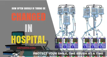Optimal IV Tubing Change Frequency in Hospitals: Best Practices