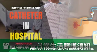 Optimal Foley Catheter Change Frequency in Hospital Settings: A Guide