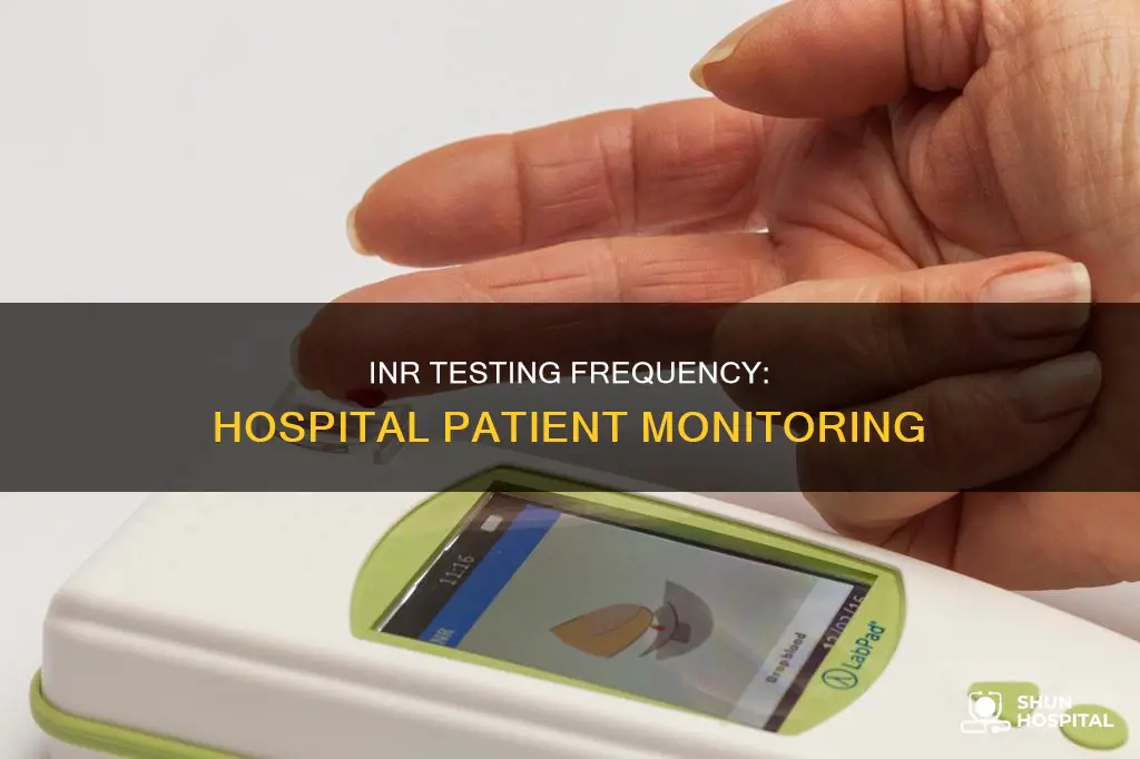 how often to check inr in hospital