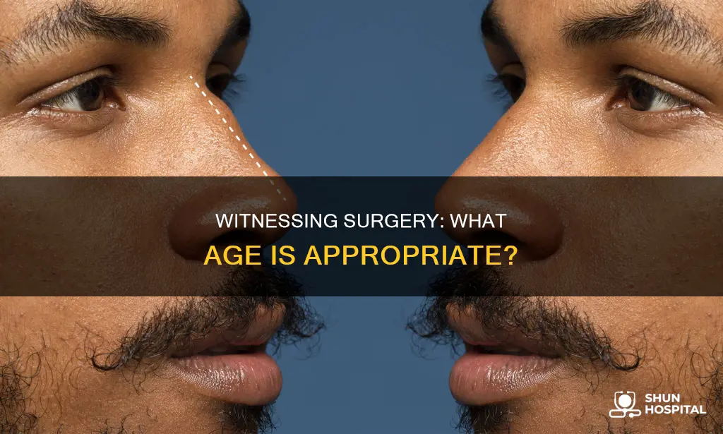 how old necessary to watch hospital surgery