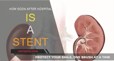 Stent Recovery: What to Expect Post-Hospitalization