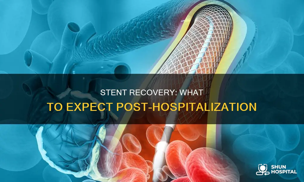 how soon after hospital is a stent