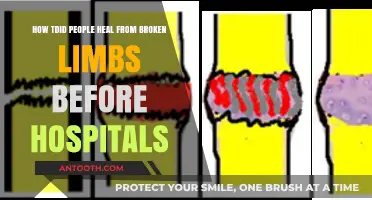 Ancient Remedies: Healing Broken Limbs Before Modern Hospitals