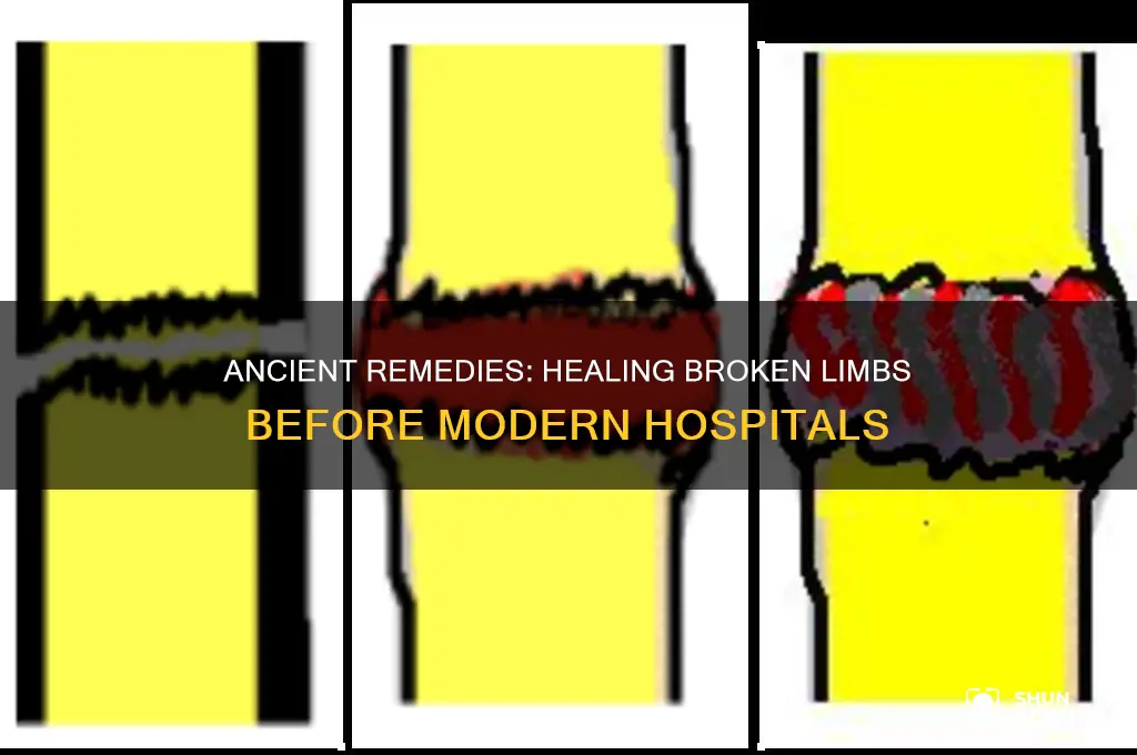 how tdid people heal from broken limbs before hospitals
