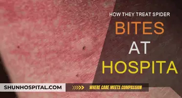 Emergency Treatment for Spider Bites: What to Expect