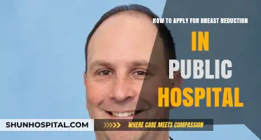 Guide to Applying for Breast Reduction in Public Hospitals