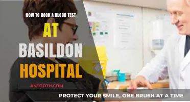 Book Your Blood Test at Basildon Hospital: A Simple Guide