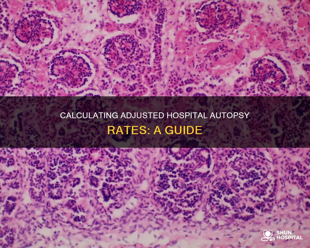 how to calculate adjusted hospital autopsy rate