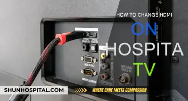 Switching HDMI on Hospital TVs: A Quick Guide