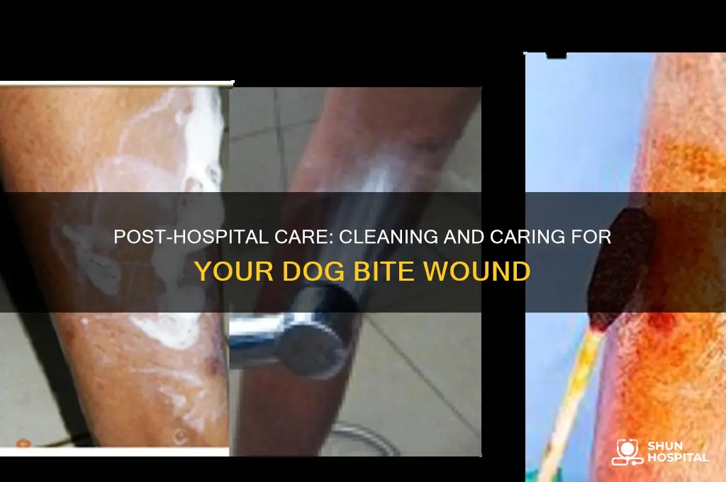 how to clean a dog bite after hospital treatment