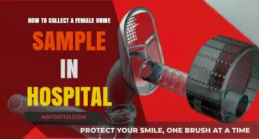 Efficient Female Urine Sample Collection: A Hospital Guide for Healthcare Professionals