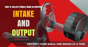 Efficient Female Urine Collection Techniques for Accurate Hospital Intake and Output Monitoring